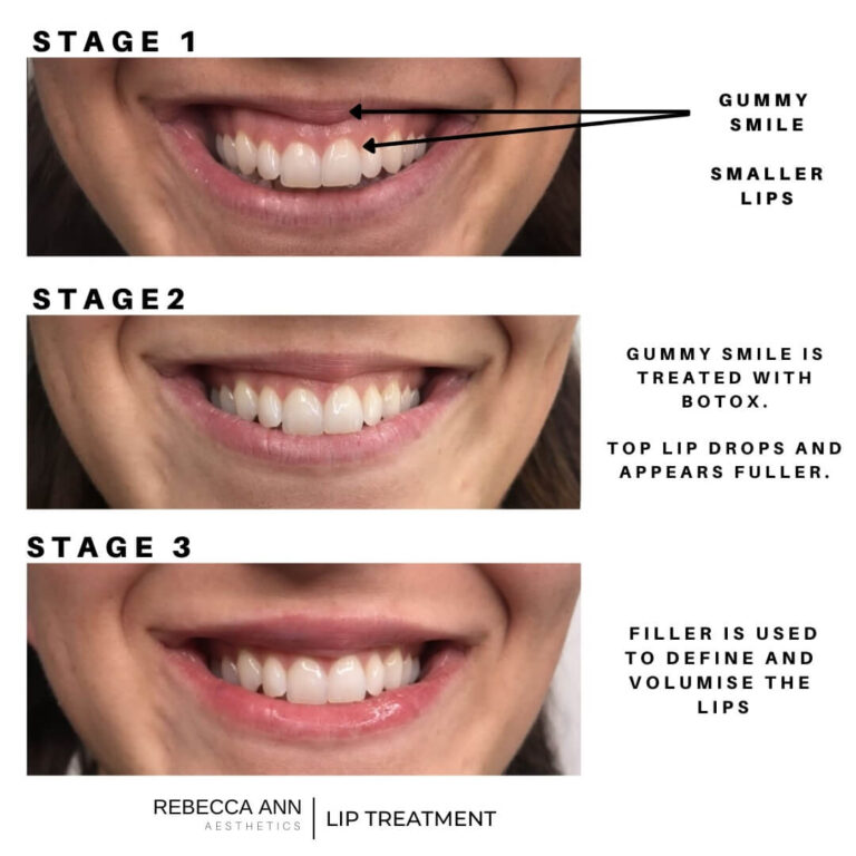 476798159_4095870110738020_6935087980206423111_n (1)