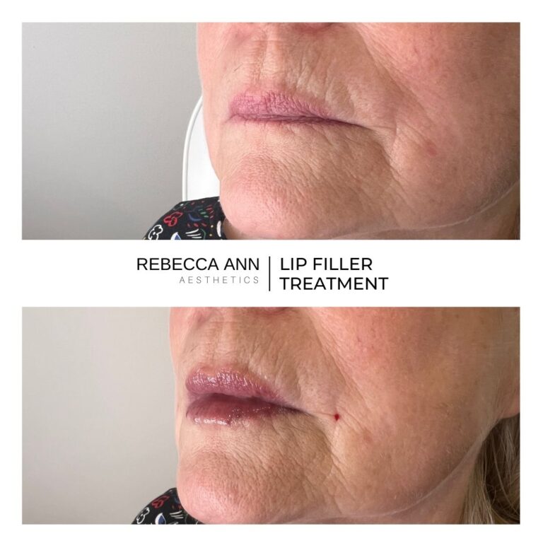 489907261_1122459309895778_1717419049854045889_n