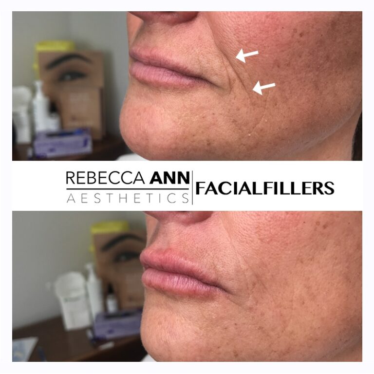 61518015_2382335862091462_5189506218074308608_n