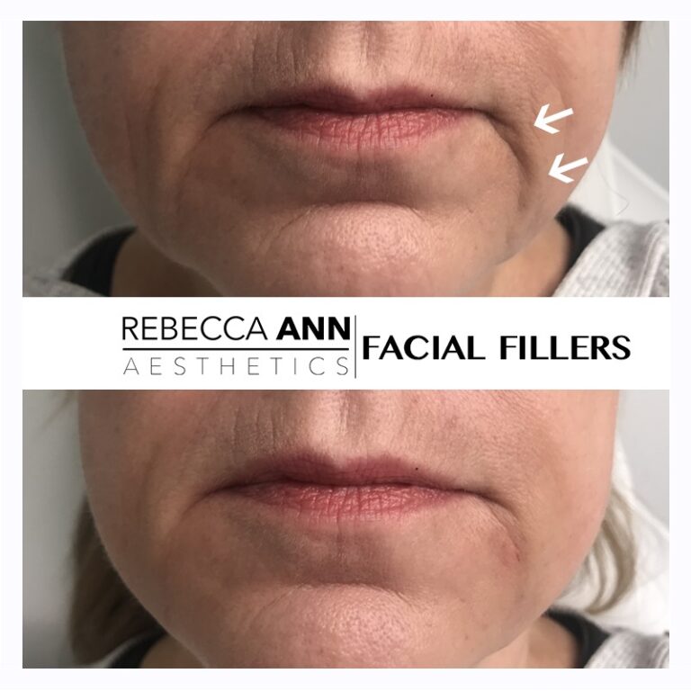 62456567_2394768197514895_8455048794722009088_n