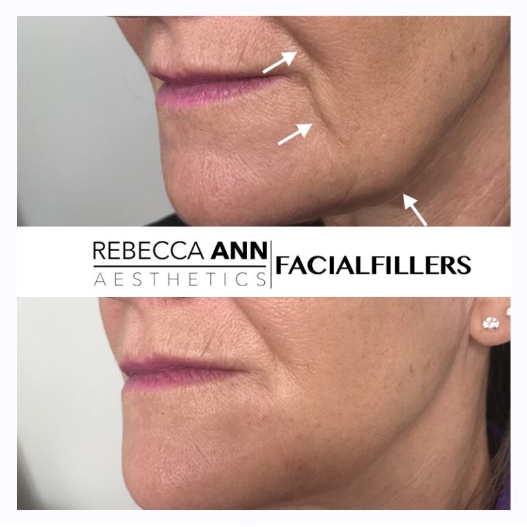 64362119_2394769190848129_6419613185547960320_n-2