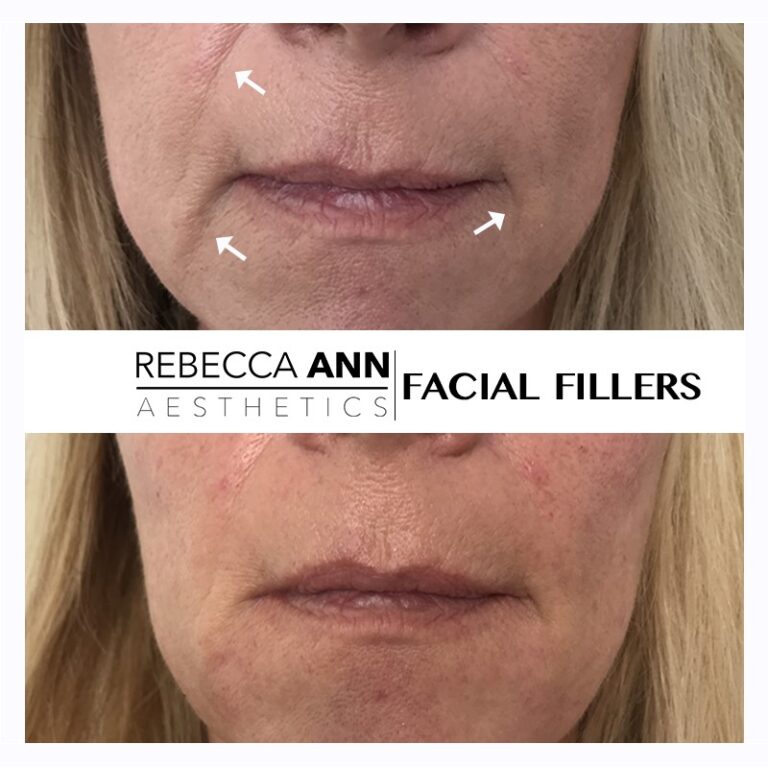 67365198_2422475694744145_4108520528002678784_n