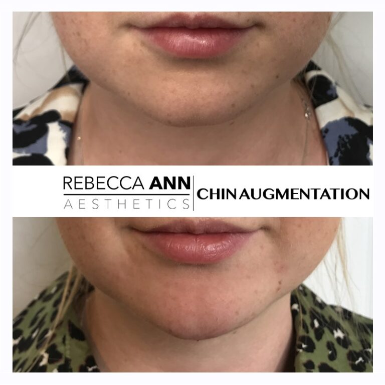 71954531_2487686511556396_2503677316060676096_n