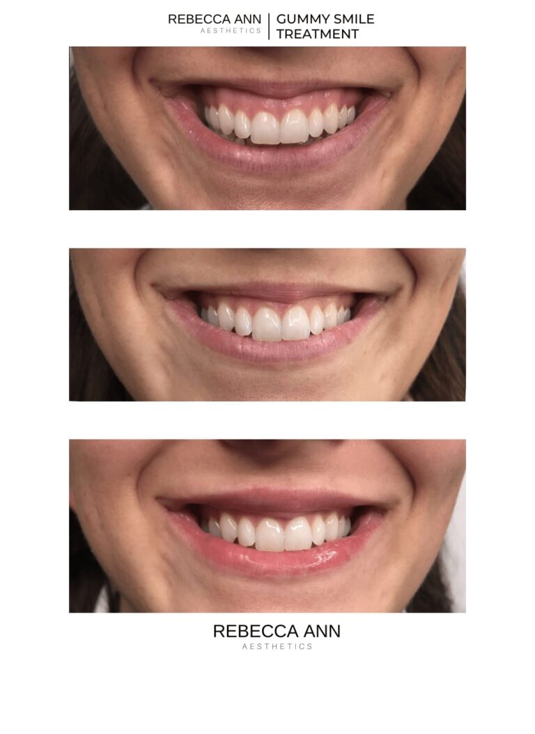 77204710_2541887009469679_8877867580321169408_n (1)