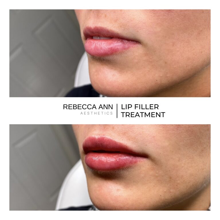 81358620_2580990865559293_8801952332557320192_n